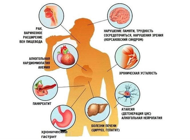 Последствия алкоголизма