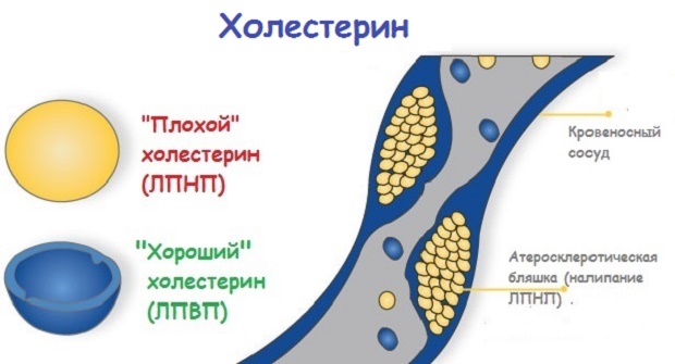 Плохой и хороший холестерин